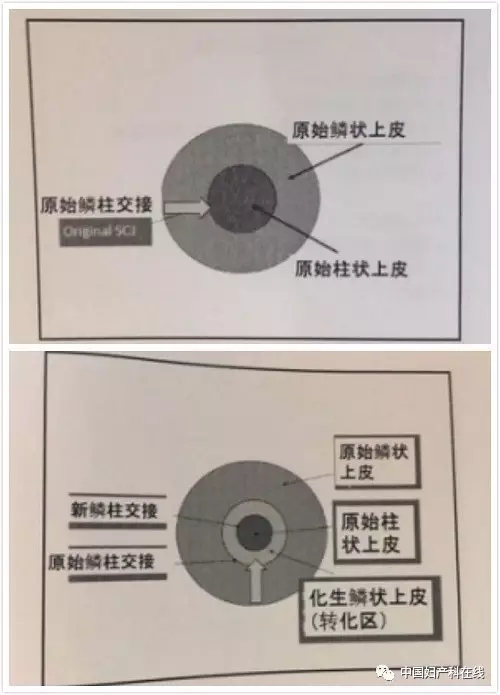 伦敦大学妇科学albert singer教授讲解了正常宫颈相关内容.