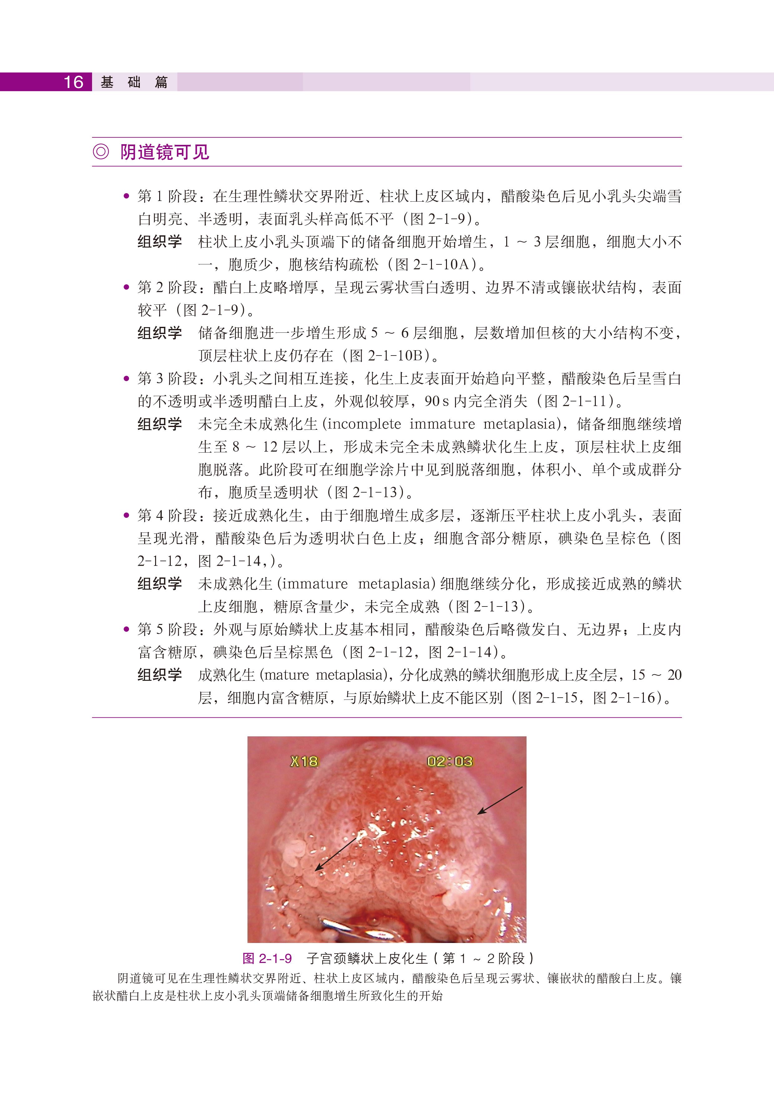 子宫颈转化区特征(2《子宫颈疾病—阴道镜图释》